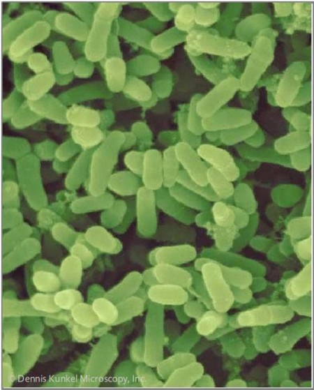 En la imagen, bacterias de la lepra, tomada de este sitio