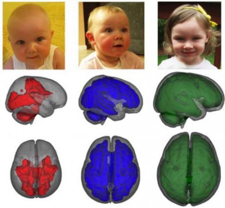 Imagen: Desarrollo de la mielización por edades (izquierda a derecha). Foto: Baby Imaging Lab/Brown University