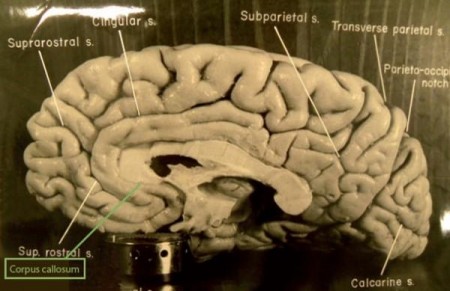 CerebroEinstein