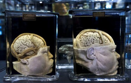 En la imagen, dos cabezas preservadas en el recientemente renovado Museo Vrolik, ubicado en el Centro Médico Académico de Amsterdam | Agencia SINC