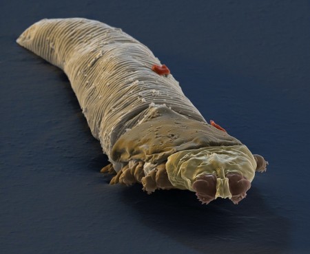 Demodex