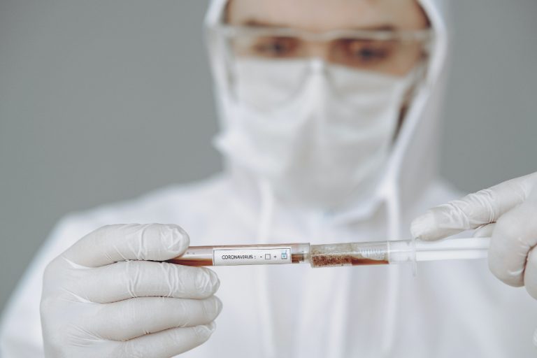 Pruebas de plasma en pacientes por covid19 2