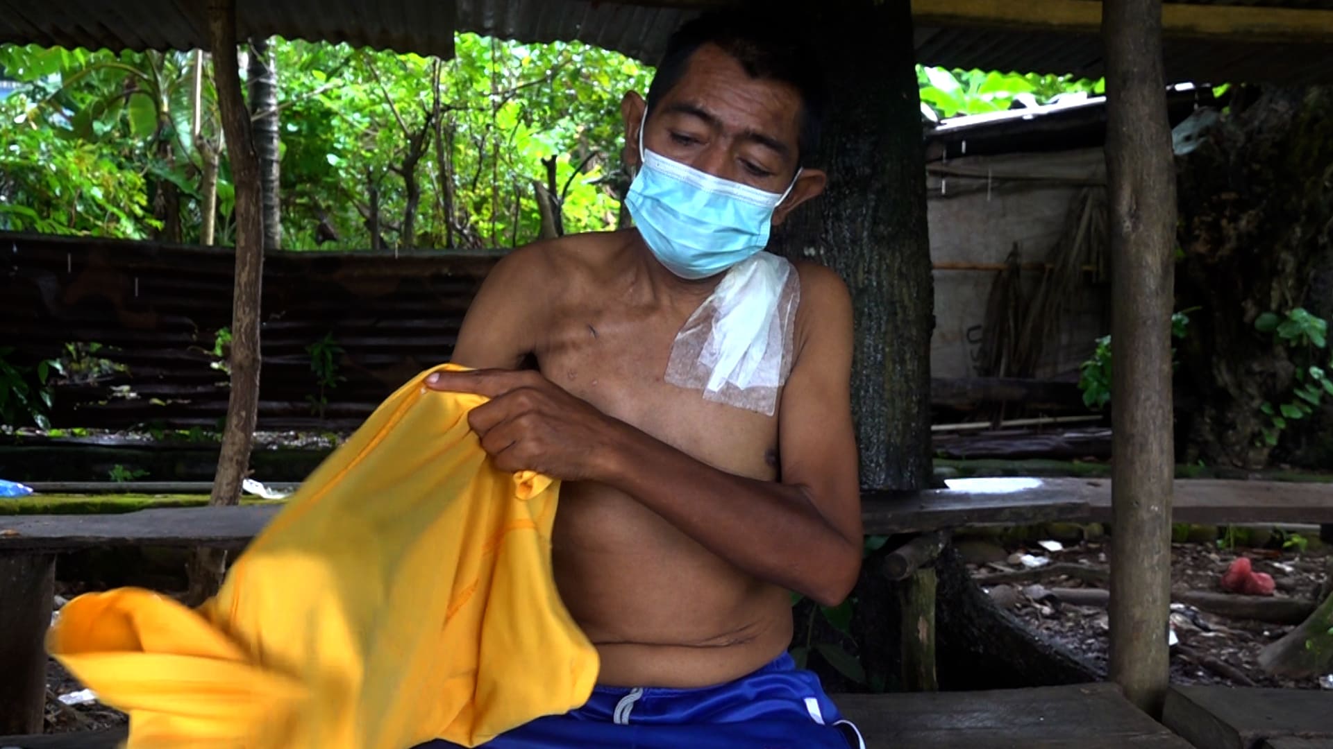 Vivir en El Salvador con enfermedad renal